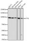 Activating Transcription Factor 6 antibody, GTX30071, GeneTex, Western Blot image 