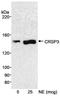 CRSP complex subunit 3 antibody, A300-425A, Bethyl Labs, Western Blot image 