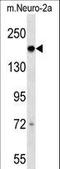 DCC Netrin 1 Receptor antibody, LS-C158192, Lifespan Biosciences, Western Blot image 