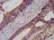 Ubiquitin Specific Peptidase 37 antibody, LS-C674504, Lifespan Biosciences, Immunohistochemistry paraffin image 