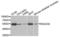 RAD23 Homolog A, Nucleotide Excision Repair Protein antibody, LS-C332409, Lifespan Biosciences, Western Blot image 
