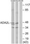 Transcriptional Adaptor 2A antibody, abx013323, Abbexa, Western Blot image 