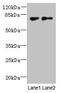 Tetratricopeptide Repeat Domain 30B antibody, CSB-PA818703LA01HU, Cusabio, Western Blot image 
