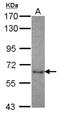 5'-Nucleotidase, Cytosolic II antibody, NBP2-19597, Novus Biologicals, Western Blot image 