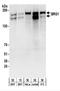 SWI/SNF Related, Matrix Associated, Actin Dependent Regulator Of Chromatin, Subfamily A, Member 4 antibody, NBP2-22234, Novus Biologicals, Western Blot image 