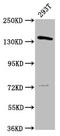POLG antibody, LS-C670062, Lifespan Biosciences, Western Blot image 