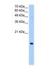 Paired Immunoglobin Like Type 2 Receptor Alpha antibody, NBP1-60095, Novus Biologicals, Western Blot image 