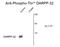 Protein Phosphatase 1 Regulatory Inhibitor Subunit 1B antibody, GTX82714, GeneTex, Western Blot image 