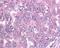 Baculoviral IAP Repeat Containing 5 antibody, GTX30241, GeneTex, Immunohistochemistry paraffin image 