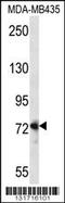 Dishevelled Segment Polarity Protein 1 antibody, MBS9215122, MyBioSource, Western Blot image 