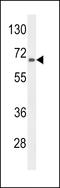 Alanine--Glyoxylate Aminotransferase 2 antibody, LS-C156167, Lifespan Biosciences, Western Blot image 