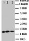 Interleukin 3 antibody, LS-C312896, Lifespan Biosciences, Western Blot image 