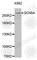 Sodium Voltage-Gated Channel Alpha Subunit 5 antibody, A1372, ABclonal Technology, Western Blot image 