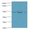 Synaptotagmin 11 antibody, LS-C379937, Lifespan Biosciences, Western Blot image 