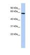 Coiled-Coil Domain Containing 96 antibody, NBP1-70489, Novus Biologicals, Western Blot image 