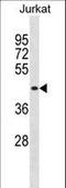 Muscleblind Like Splicing Regulator 1 antibody, LS-C157881, Lifespan Biosciences, Western Blot image 