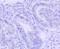 Pim-1 Proto-Oncogene, Serine/Threonine Kinase antibody, 13-906, ProSci, Immunohistochemistry frozen image 