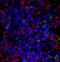 CD20 antibody, PA5-32313, Invitrogen Antibodies, Immunofluorescence image 