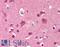 FYN Proto-Oncogene, Src Family Tyrosine Kinase antibody, LS-B1876, Lifespan Biosciences, Immunohistochemistry paraffin image 