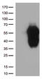 Hepatitis A Virus Cellular Receptor 2 antibody, CF812559, Origene, Western Blot image 