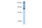 Homeodomain Interacting Protein Kinase 2 antibody, 27-639, ProSci, Western Blot image 