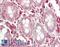 ERGIC And Golgi 3 antibody, LS-C318338, Lifespan Biosciences, Immunohistochemistry paraffin image 