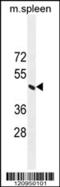 ERCC Excision Repair 8, CSA Ubiquitin Ligase Complex Subunit antibody, 55-526, ProSci, Western Blot image 