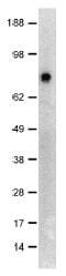 NDC80 Kinetochore Complex Component antibody, ab3613, Abcam, Western Blot image 