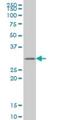 Glutathione S-Transferase Zeta 1 antibody, H00002954-M01, Novus Biologicals, Western Blot image 