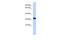 Dimethylarginine Dimethylaminohydrolase 2 antibody, 27-196, ProSci, Western Blot image 