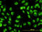 DExH-Box Helicase 9 antibody, LS-B5394, Lifespan Biosciences, Immunofluorescence image 