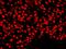 Nuclear Mitotic Apparatus Protein 1 antibody, A301-509A, Bethyl Labs, Immunohistochemistry paraffin image 
