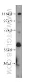 6-Phosphofructo-2-Kinase/Fructose-2,6-Biphosphatase 2 antibody, 17838-1-AP, Proteintech Group, Western Blot image 