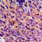 Nuclear Factor Kappa B Subunit 1 antibody, LS-C352581, Lifespan Biosciences, Immunohistochemistry paraffin image 