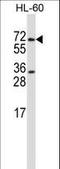 Protein Arginine Methyltransferase 5 antibody, LS-C162164, Lifespan Biosciences, Western Blot image 