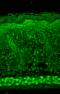 Hypoxia Inducible Factor 1 Subunit Alpha Inhibitor antibody, M02116, Boster Biological Technology, Immunohistochemistry paraffin image 