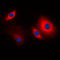 Cortactin antibody, LS-C353339, Lifespan Biosciences, Immunofluorescence image 