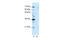 Splicing Factor 1 antibody, 29-533, ProSci, Western Blot image 