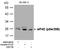 Eukaryotic Translation Initiation Factor 4E antibody, GTX50268, GeneTex, Western Blot image 