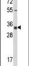 Calponin 3 antibody, PA5-13524, Invitrogen Antibodies, Western Blot image 