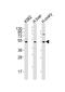 Lymphocyte Activating 3 antibody, 62-572, ProSci, Western Blot image 