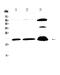 Protein Phosphatase 1 Regulatory Inhibitor Subunit 14A antibody, PA5-79858, Invitrogen Antibodies, Western Blot image 