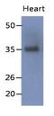 Sarcoglycan Delta antibody, GTX53783, GeneTex, Western Blot image 