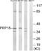 Pre-MRNA Processing Factor 18 antibody, PA5-39356, Invitrogen Antibodies, Western Blot image 