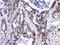 Heterogeneous Nuclear Ribonucleoprotein F antibody, A05806, Boster Biological Technology, Immunohistochemistry frozen image 