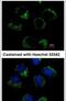 Carnitine O-Acetyltransferase antibody, PA5-27829, Invitrogen Antibodies, Immunofluorescence image 