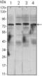 Component Of Inhibitor Of Nuclear Factor Kappa B Kinase Complex antibody, GTX82770, GeneTex, Western Blot image 