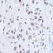 Aggrecan antibody, GTX03179, GeneTex, Immunohistochemistry paraffin image 