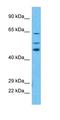 WD Repeat Domain 46 antibody, orb326455, Biorbyt, Western Blot image 