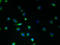 Transmembrane Protein 45A antibody, A61426-100, Epigentek, Immunofluorescence image 